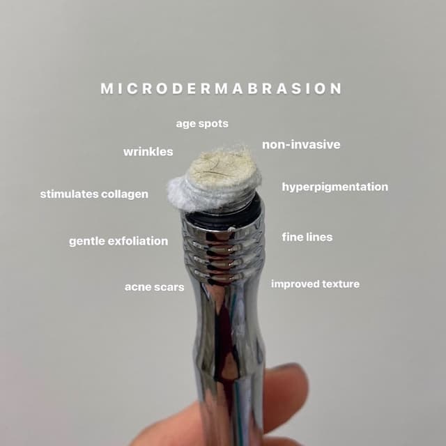 Microdermabrasion-Triple Glow at Beauty By Manhattan & Spa in Spearfish, SD